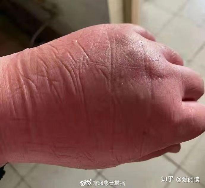 河北新增本土无症状28例,河北新增69例无症状行动轨迹