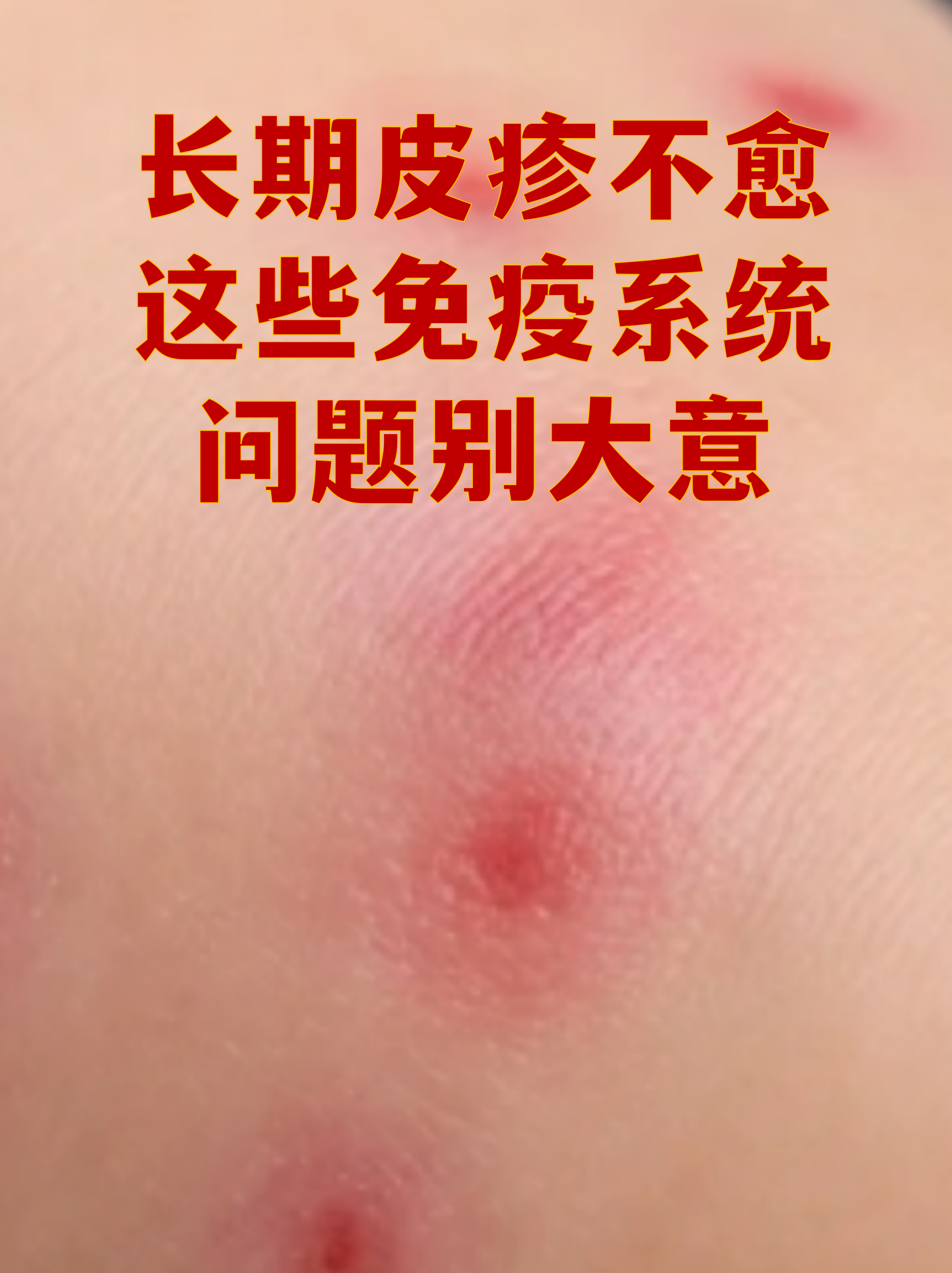 “上海社会面新增1例无症状” 上海一例无症状?-第1张图片